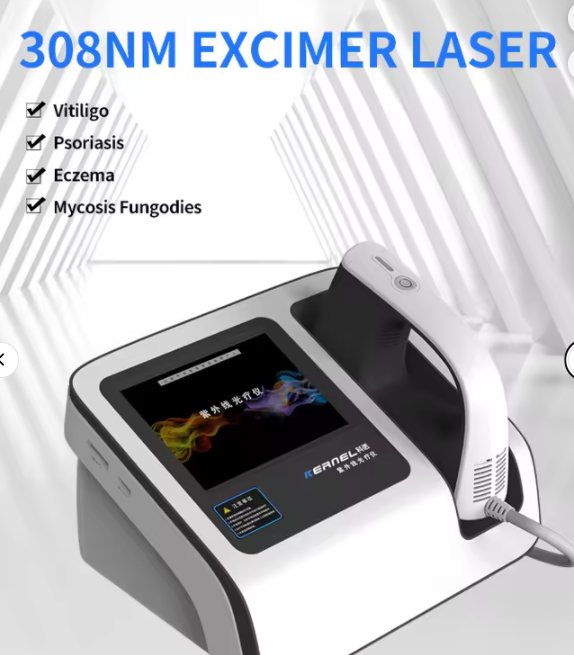 308 Nm Equipment Single Wavelength Excimer Light Output Via the Medium Xeci for Treatment Vitiligo Psoriasis