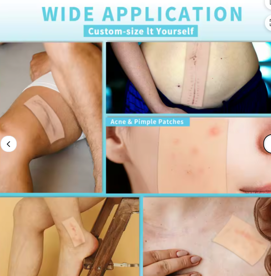 Hydrocolloid Pimple Patches for Breakouts Large Acne Patches for Face, Chin, Back and Body