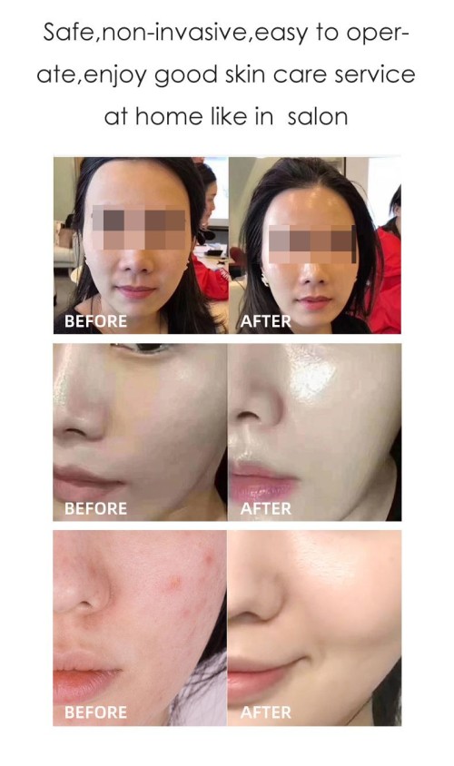 Vacuum Emulsifying Machine Vacuum Emulsifier Mixer Lotion Mixing Machine Skin Whitening Cream Making Machine