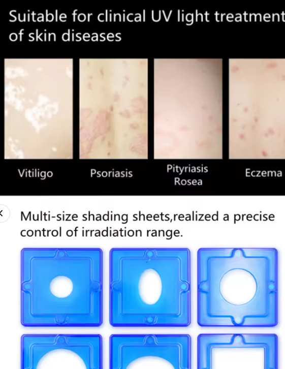 308 Nm Equipment Single Wavelength Excimer Light Output Via the Medium Xeci for Treatment Vitiligo Psoriasis