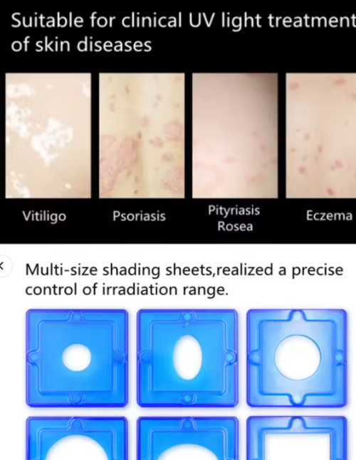 308 Nm Equipment Single Wavelength Excimer Light Output Via the Medium Xeci for Treatment Vitiligo Psoriasis